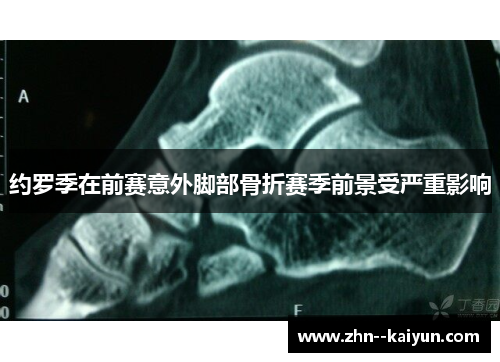 约罗季在前赛意外脚部骨折赛季前景受严重影响